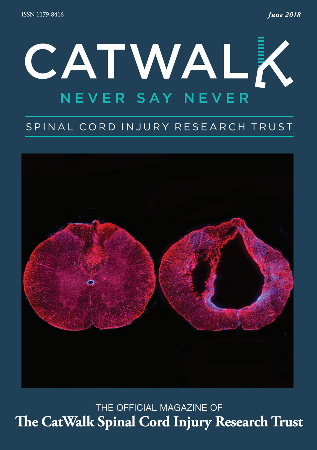 CatWalk Magazine Covers June 2018